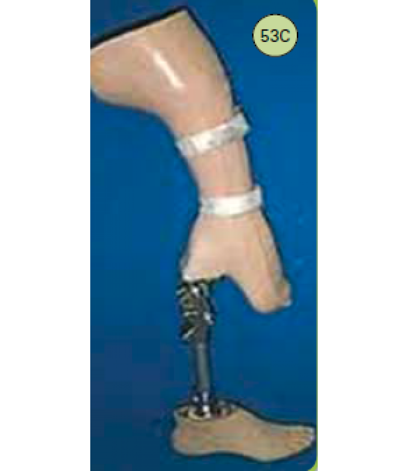 EXTENSION PROSTHESIS