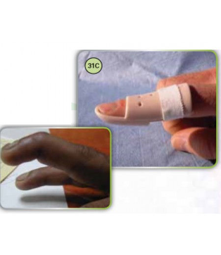 MALLET FINGER STAX SPLINT