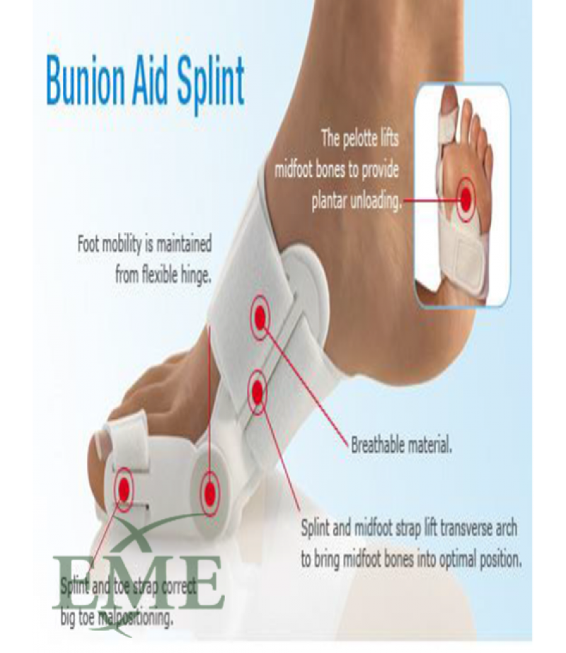 DYNAMIC HALLUX VALGUS SPLINT